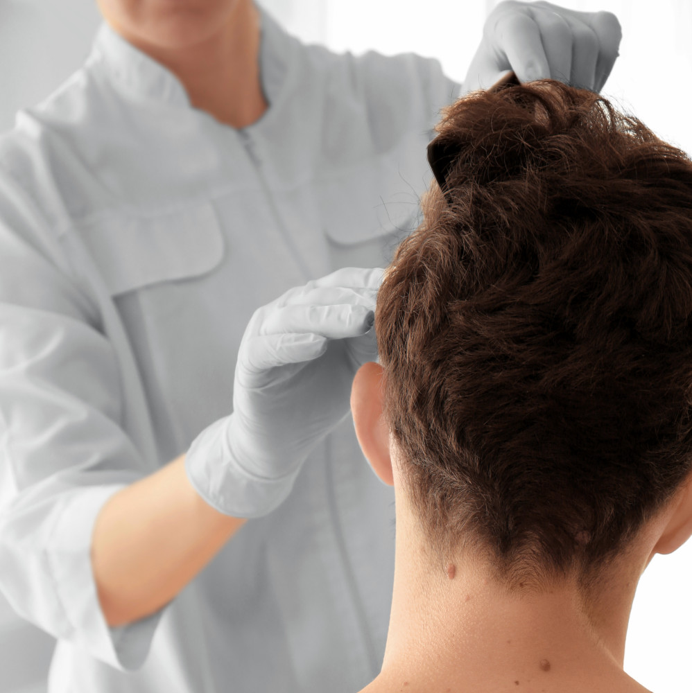 Consult a doctor for your hair loss diagnosis - Martinick Hair Restoration